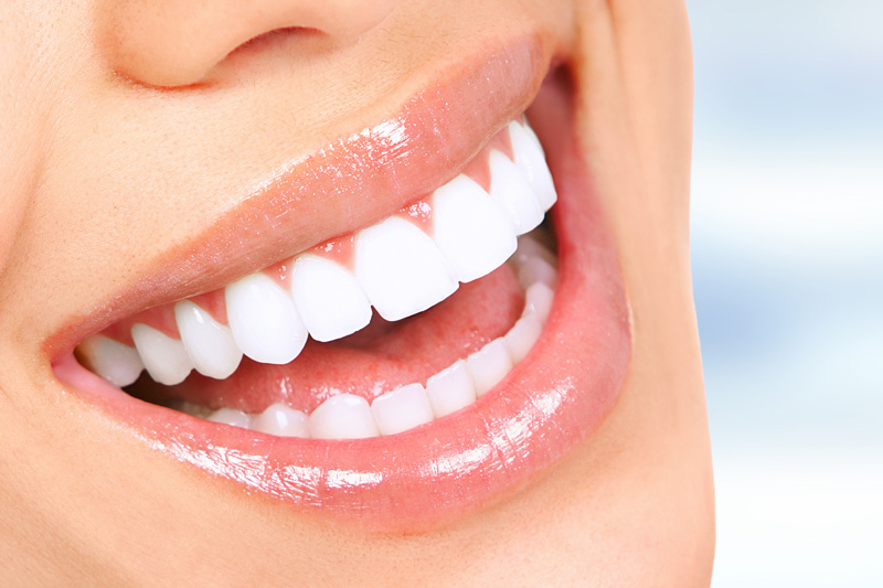Cosmetic Dentistry in Highland